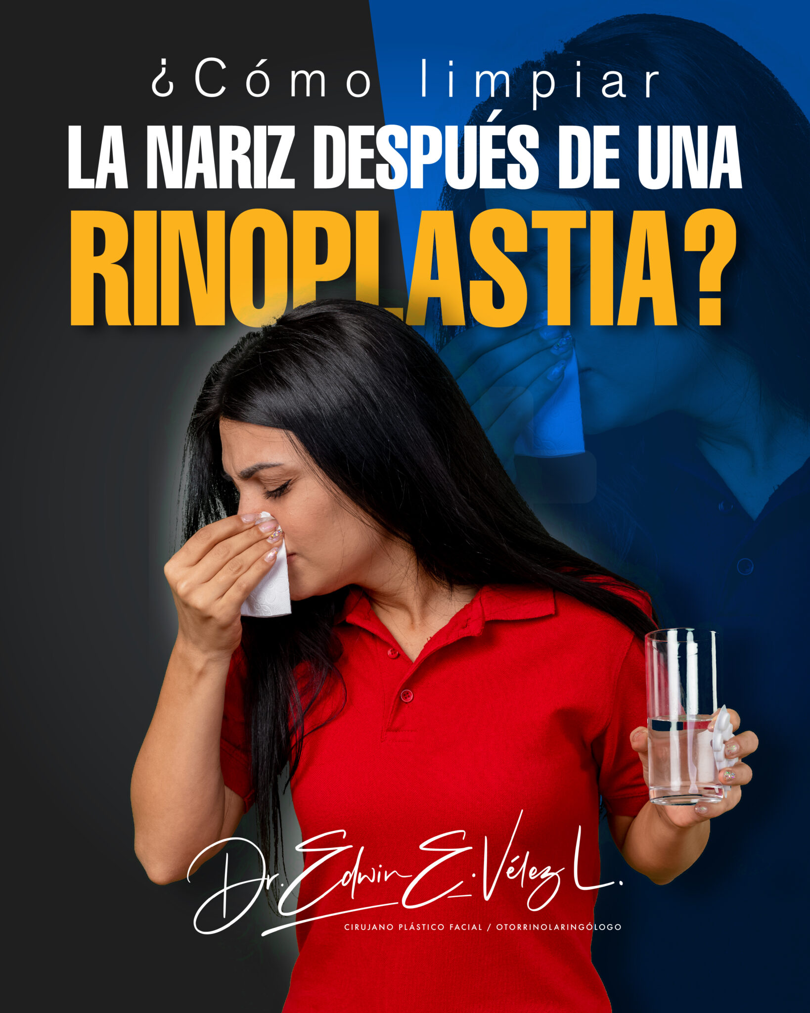 ¿Cómo limpiar la nariz después de una rinoplastia? Doctor Edwin Vélez